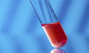 渔业行业现状与发展趋势分析2024(图7)